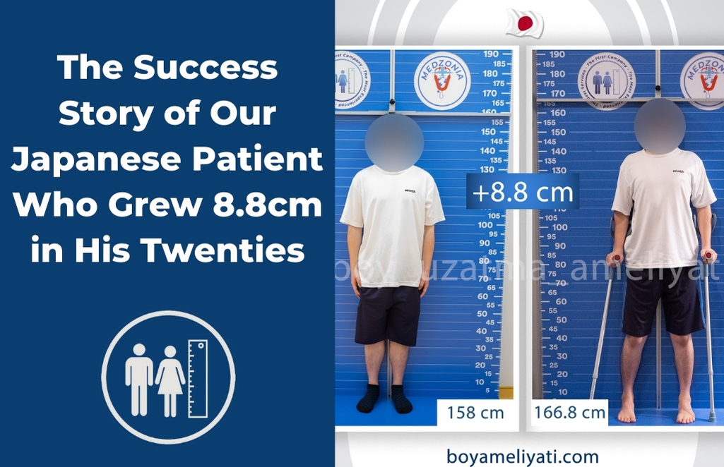 The Success Story of Our Japanese Patient Who Grew 8.8cm in His Twenties